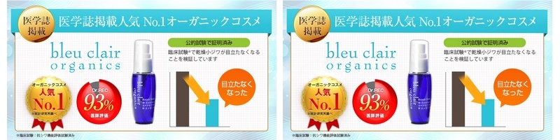 �u���[�N���[�����Y�����ϕi�̃X�L���P�A�g���C�A���Z�b�g���T�C�g